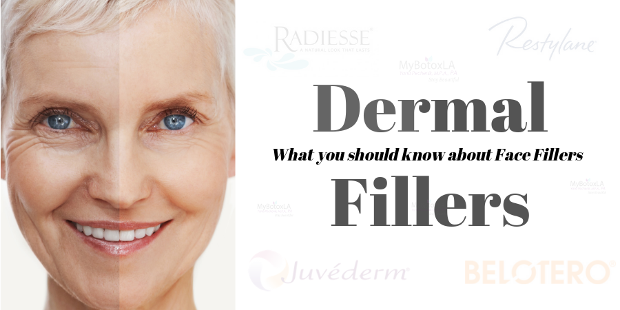 fillers, juvederm, restylane