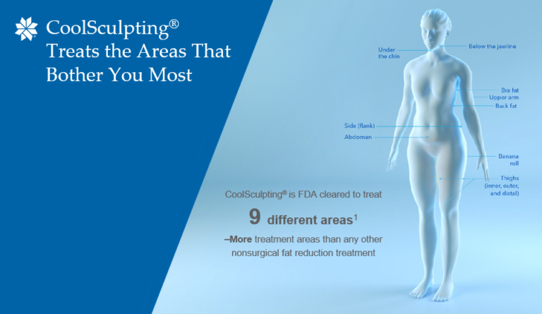 coolsculpting elite
