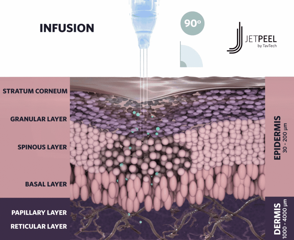 jetpeel rhode island