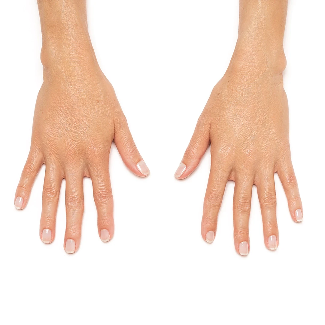 Smooth, full-looking backs of the hands