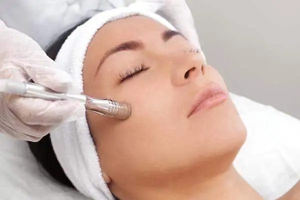 Client having a microneedling treatment on her cheek
